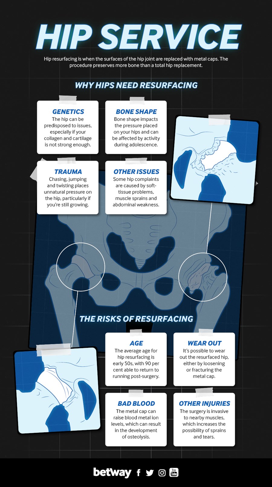 hip-graphic