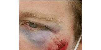 Six Officers Injured During Seattle Riot