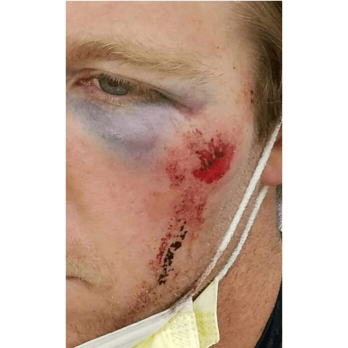 Six Officers Injured During Seattle Riot