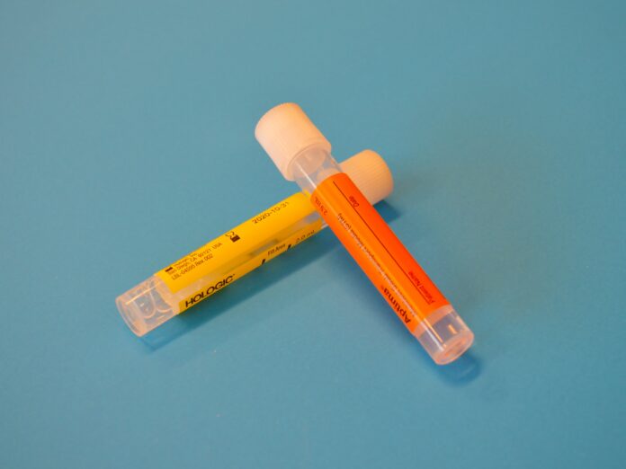 SF Medical Examiner Arrested For Drug Possession