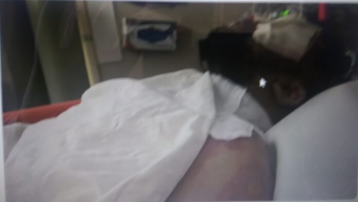 Store Clerk Injured After Being Set On Fire