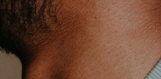 BB Pellet Grazes Neck Of Kyle Franks