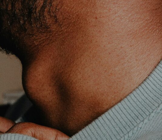 BB Pellet Grazes Neck Of Kyle Franks